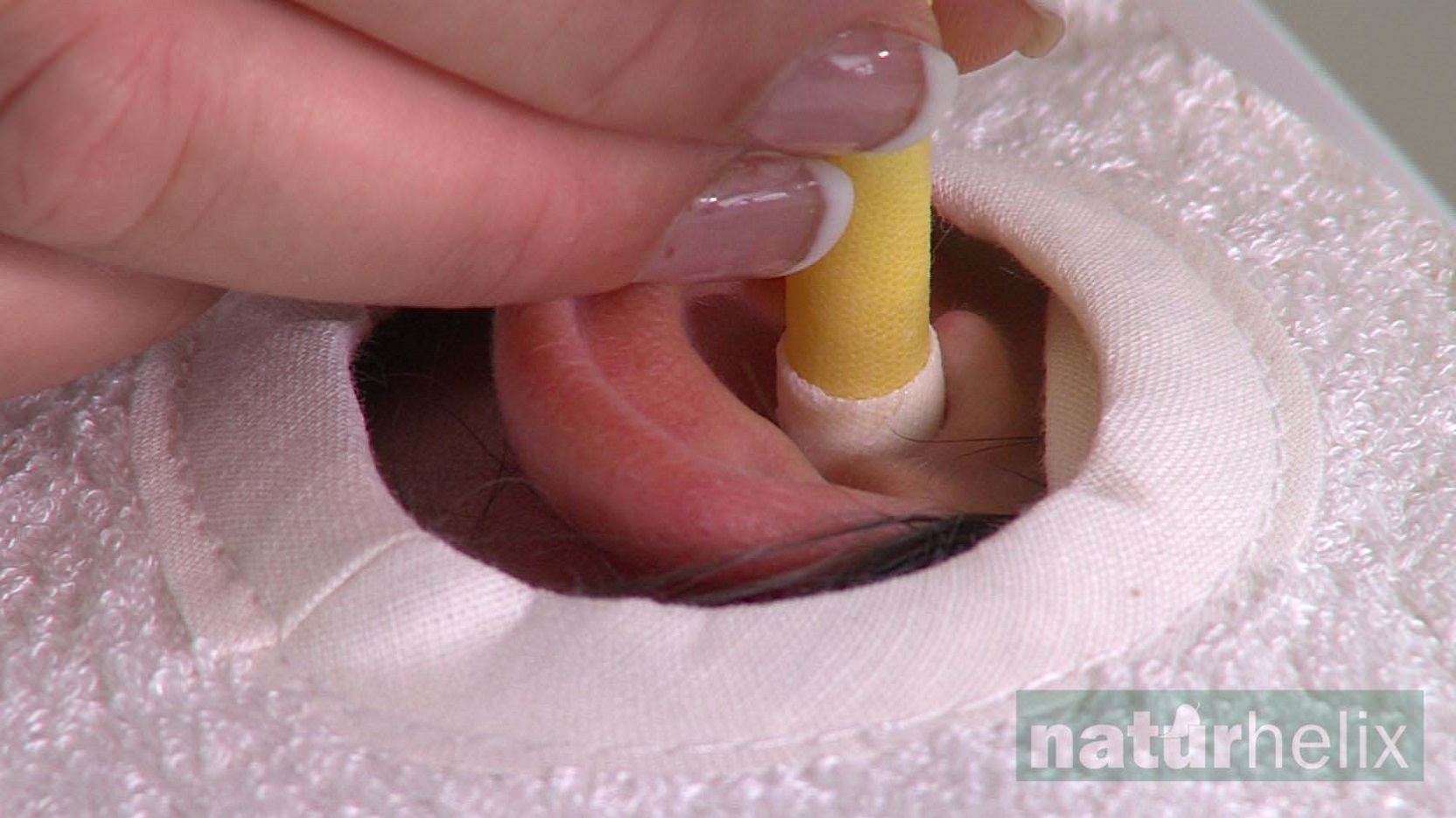 Hogyan működik a fülgyertya?